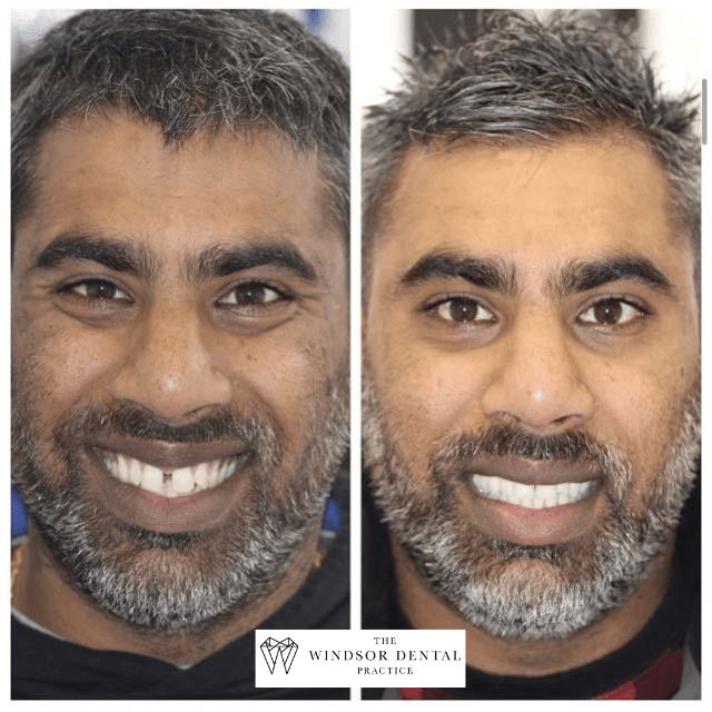 Happy Patient