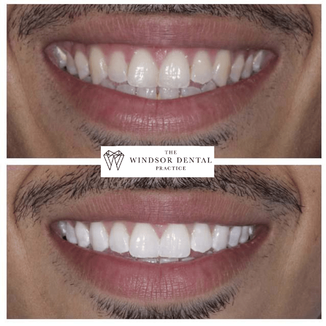 Happy Patient