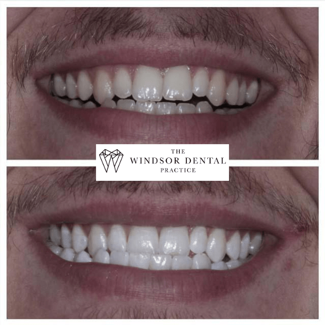Happy Patient