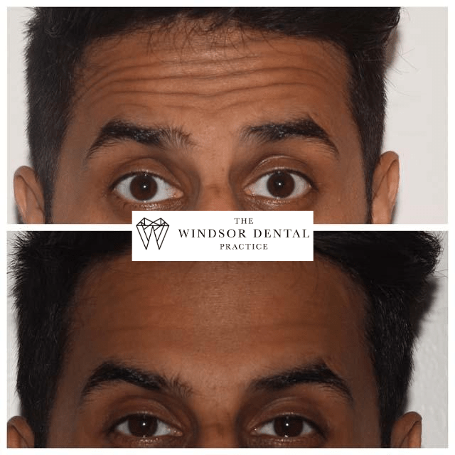 Happy Patient