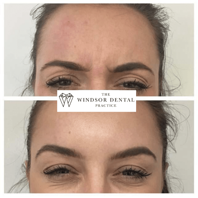 Happy Patient