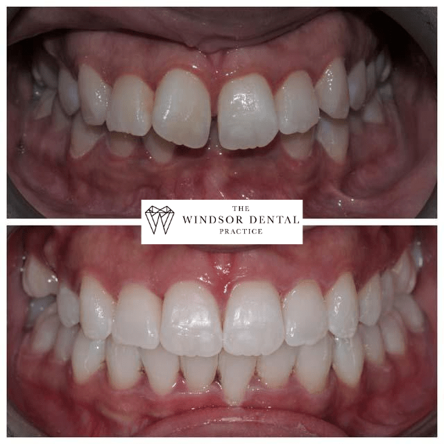 Happy Patient