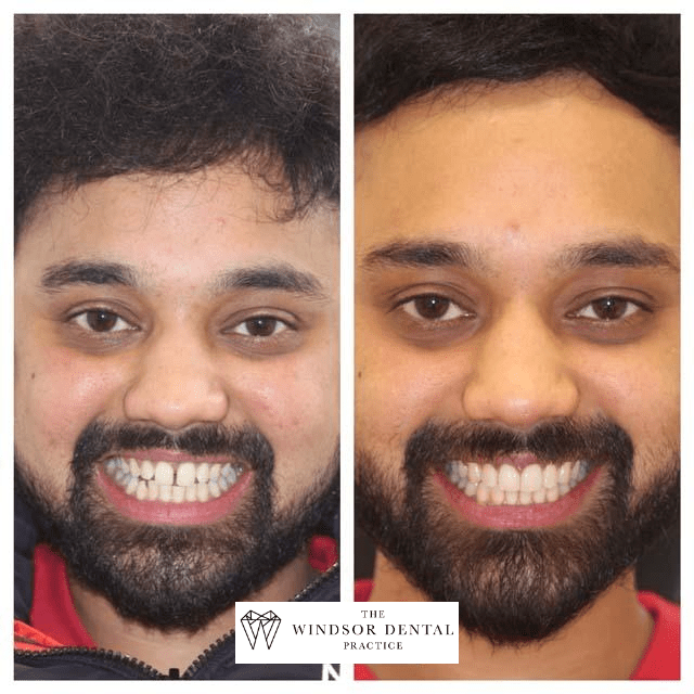 Happy Patient