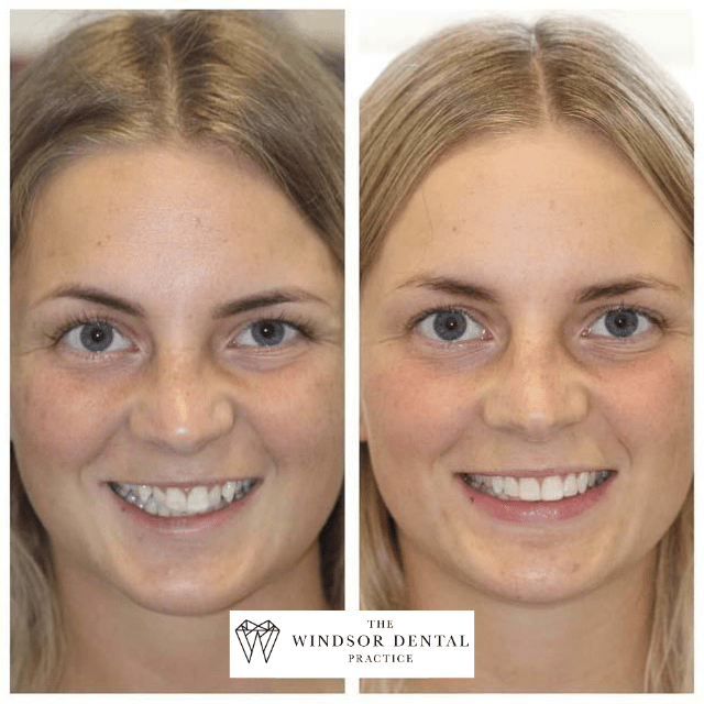 Happy Patient