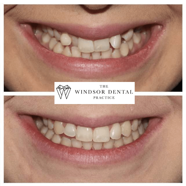 Happy Patient