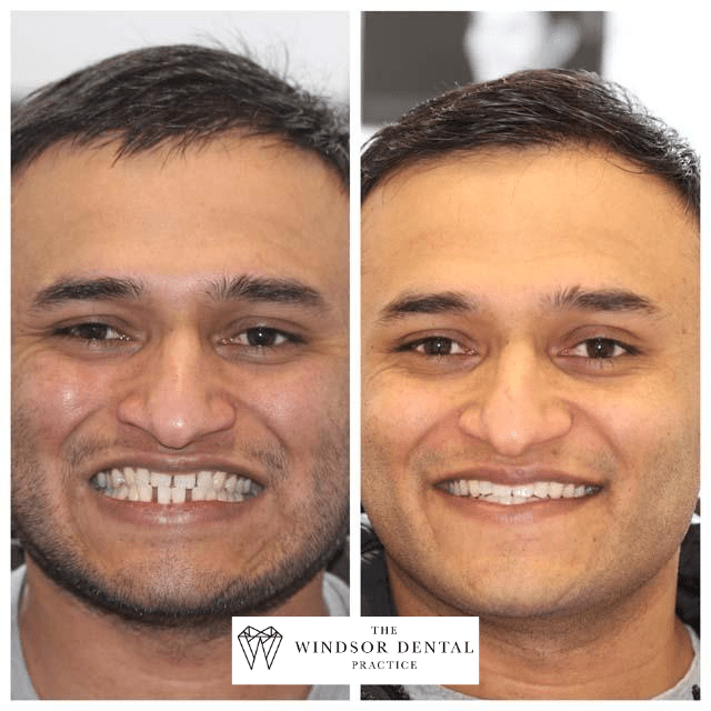 Happy Patient