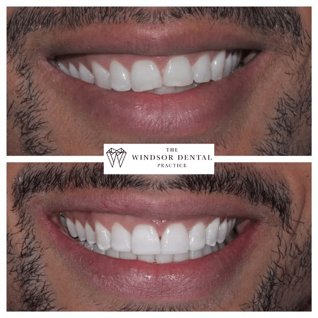 Happy Patient