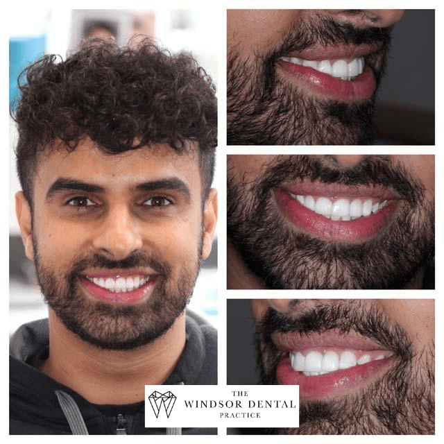 Happy Patient