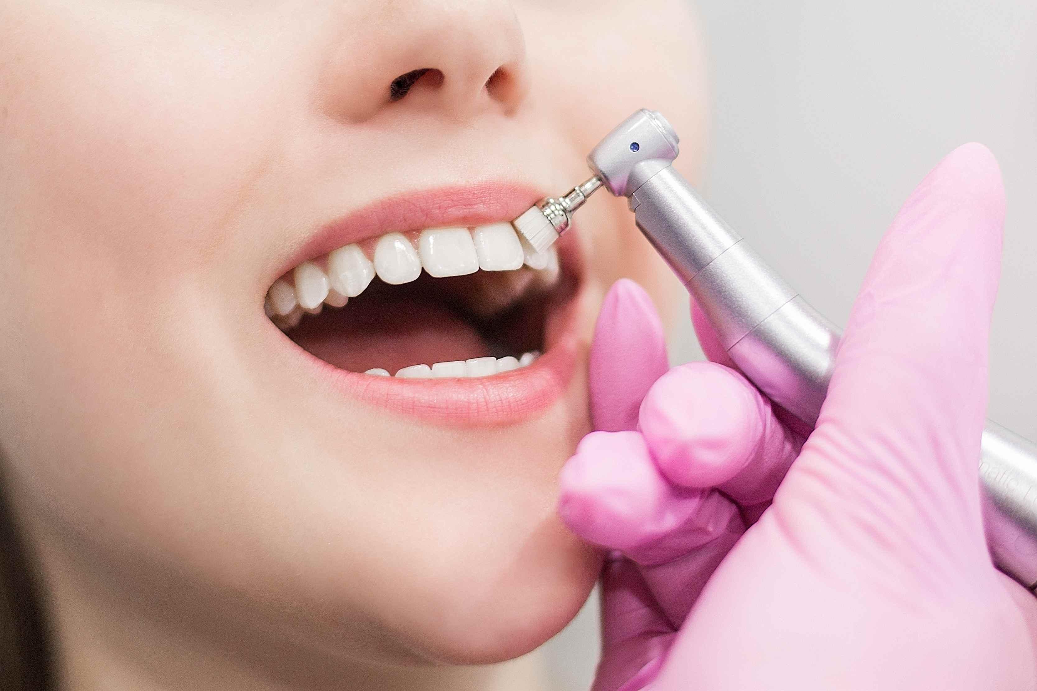Dental Cleaning