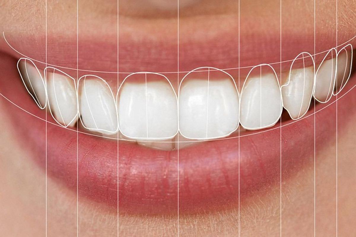 Digital Smile Design