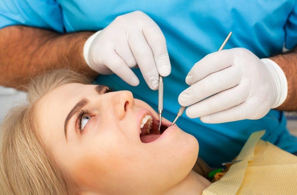 Wisdom Teeth Removed