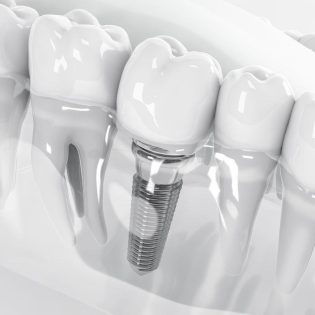 2dental