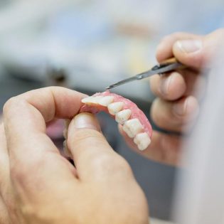 Dental technician crafting a custom full denture for a patient at The Windsor Dental Practice Leicester
