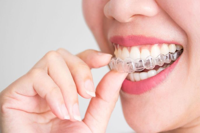 patient wearing Invisalign clear aligners comfortably during daily routine in Leicester