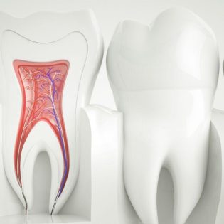 Root Canal After Care