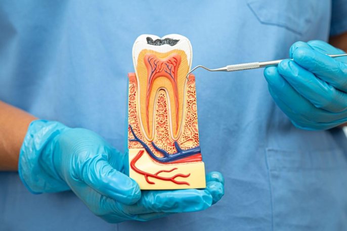 Dentist holding tooth cross-section model explaining root canal procedure at Windsor Dental Leicester