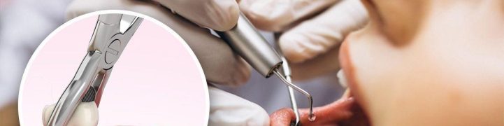 Dentist performing safe and gentle tooth extraction at Windsor Dental Practice Leicester
